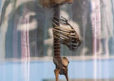 El Abrazo de Suárez- Museo Historia de la Medicina-18