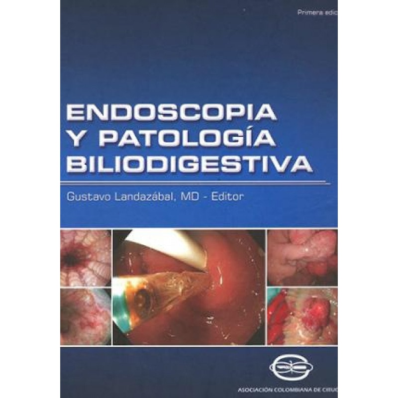 máscara interfaz sal Endoscopia y patología Bilio-digestiva - Academia Nacional de Medicina de  Colombia