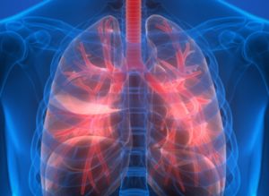 enfermedades-pulmonares