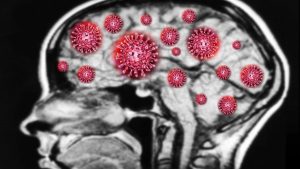 neurología y covid-19