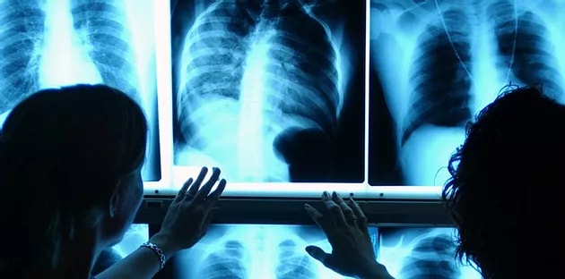 8 de Noviembre. Día Mundial de la Radiología