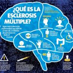 esclerosis-multiple