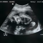 feto-bebe en gestación