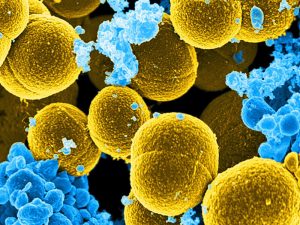 Staphylococcus aureus