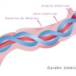 cordón umbilical y celulas madre