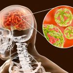 encefalitis-japonesa-ilustración