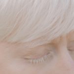 albinismo-sensibilización-albinismo