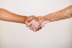 vitiligo-día mundial vitiligo