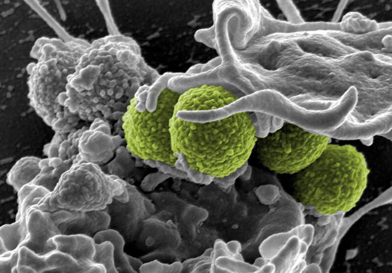 bacteria ‘S. aureus’