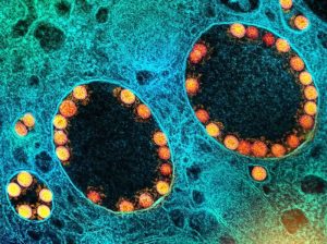 Partículas-del-virus-SARS-CoV-2-dentro-de-los-endosomas-de-una-célula-epitelial-nasal