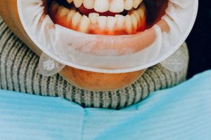 salud bucal-dientes