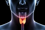 cancer-de-tiroides