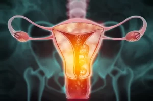 virus_papiloma_humano_cancer_cuello_uterino