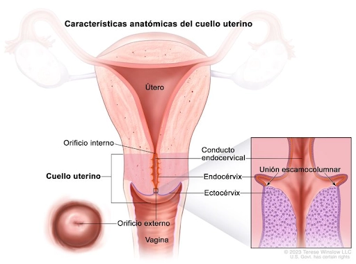 cancer_de_cuello_uterino