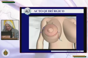 cirugia_mamas_Dra_Manuela_Berrocal