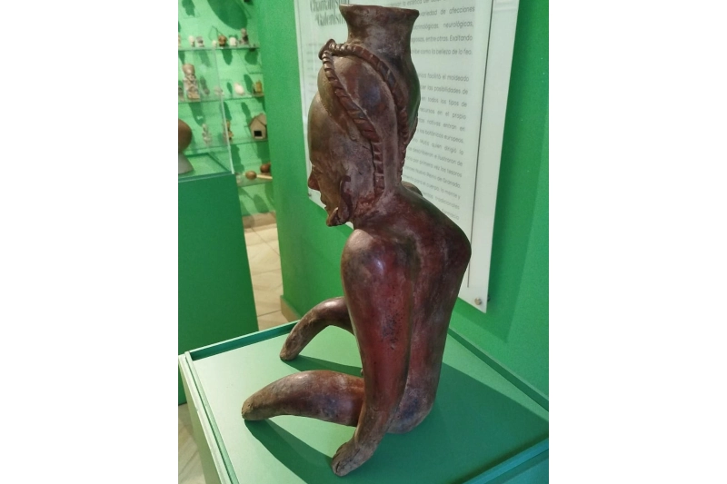 Tuberculosis en una cultura prehispánica en Colombia