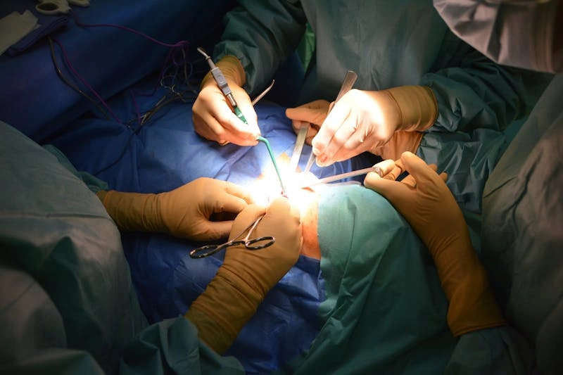 trasplante_de_organos